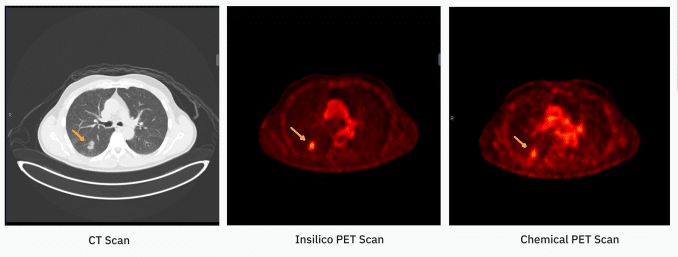 牛津大学衍生企业RADiCAIT运用人工智能降低诊断成像成本并提升可及性——敬请关注TechCrunch Disrupt 2025创新大会。